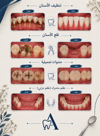 علاج أسنان مجاني • جامعة المعقل • تنظيف قلع حشوات