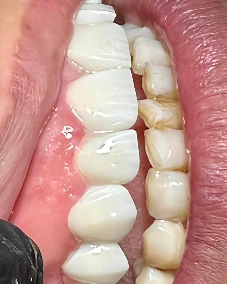 مجمع اهلنا النموذجي الطبي 
عيادة أونو 
لطب تجميل الأسنان 
بتواجد 
الدكتور محمد رحم الحجامي 
والدكتور احمد الصافي 
العنوان خلف سيد جعفر 
نهاية شارع الصناعي 
الديوانية قضاء البدير 
للحجز والاستفسار 
***********
