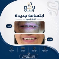صناعة الابتسامة ليست مجرد عمل طبي، بل فن يغير التفاصيل ويعيد الثقة." #...