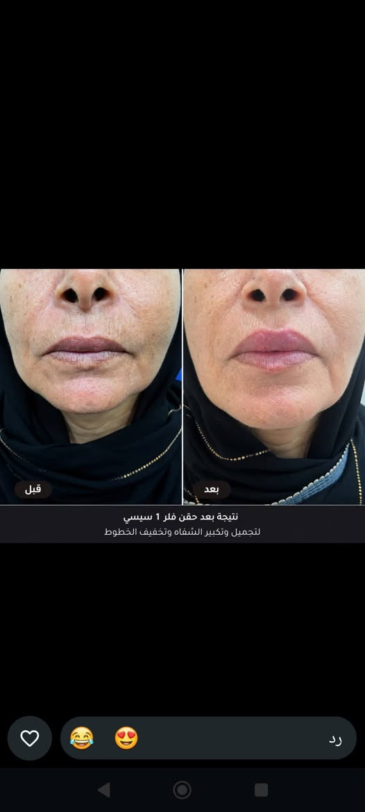 مكاني السيديه + الاعضميه للحجز على رقم الهاتف
***********

