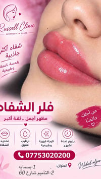 فلر شفه • شفة ناعمة • بسمايه التأميم