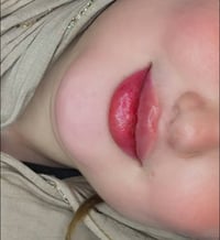 فلر شفة • عروض • تجميل