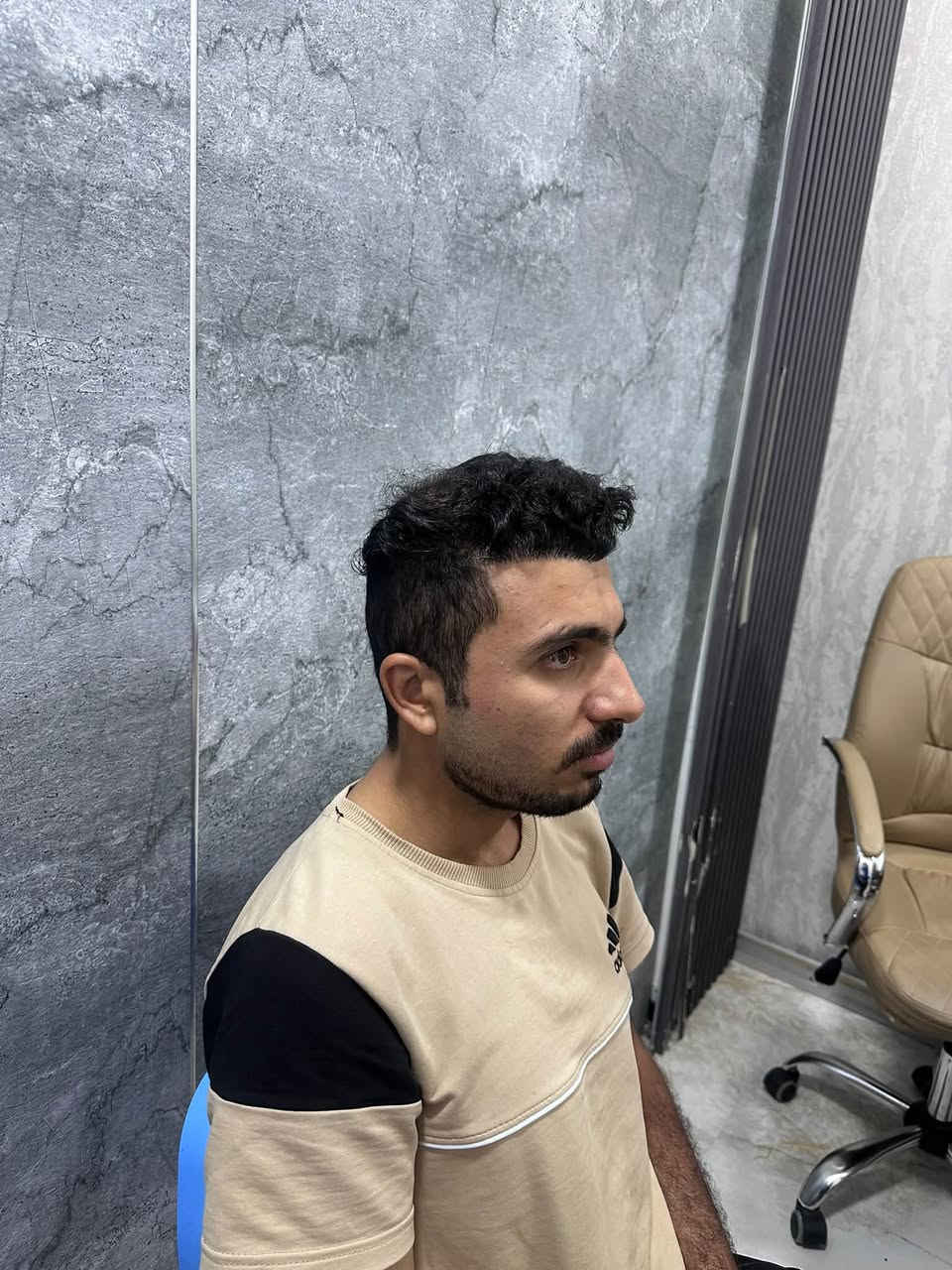 عيادة استيرا • زراعة شعر • الرمادي الانبار