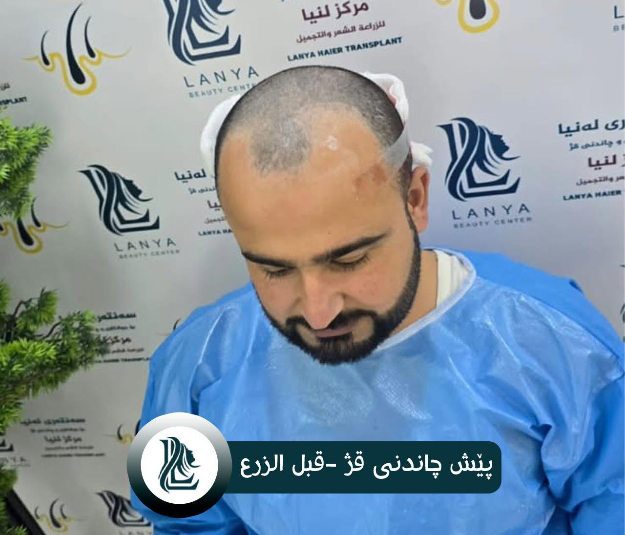 استعد كثافة شعرك من جديد! 
في مركز لەنيا للتجميل و زراعة الشعر ، نساعدك على استعادة مظهر الشعر الطبيعي والأكثر كثافة من خلال زراعة الشعر.
🌿 نتائج طبيعية | 👨‍⚕️ خبرة واحترافية | ✨ عناية بأدق التفاصيل
لەنيا — لأن جمالك يستحق الأفضل. 🤍
♦ مع لەنیا حافظ على شبابك.
📍 العنوان:كلار - شارع ليوا - قرب جامع بخاري
📞 رقم التواصل:
***********
--------
قژێکی پڕتر، متمانەیەکی زیاتر! 
لە سەنتەری جوانکاری لەنیا، بە چاندنی قژ هەنگاوێک بەرەو قژێکی جوانتر و سروشتی‌تر بنێ.
🌿 ئەنجامی سروشتی | 👨‍⚕️ پسپۆڕی | ✨ گرنگیدان بە وردەکاری
♦ لەگەڵ لەنیا هەمیشە بەگەنجی دەمێنێتەوە
📍 ناونیشان: کەلار- شەقامى لیواکە - نزیک مزگەوتی بوخاری
📞 ژمارەی پەیوەندی: ***********
