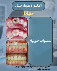 علاج أسنان مجاني • حشوات ضوئية • الناصرية التضحية