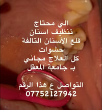 علاج مجاني • تنظيف اسنان • جامعة المعقل