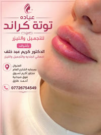 توتة كراند • ليزر • بسمايه