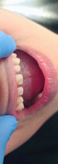 ابتسامتك هي أول انطباع… خليها دايمًا مشرقة ✨🦷   بعيادتنا نهتم بأدق الت...