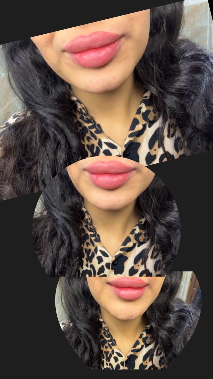 عرض • عيادة نوران • جلدية وتجميل