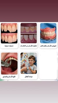 عيادات جامعة الكوفه • علاج مجاني • حشوات وقلع