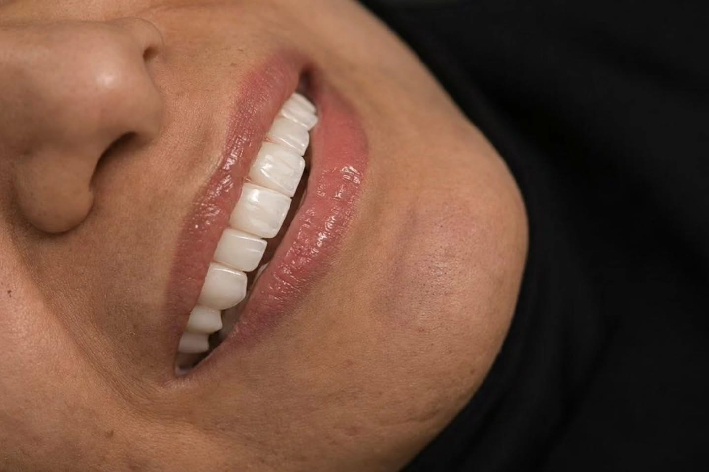 فرصة ما تتعوض

عالج أسنانك بخصومات خاصة لفترة محدودة

مراكز الشركة الطبية العالمية تمنحكم ابتسامة مشرقة 

#مراكز_الشركة_الطبية_العالمية #بغداد #تبييض_الاسنان #تقويم_اسنان #العراق

العنوان : طويريج _الشارع العام_مجاور نقابة المعلمين _مقابل المكتبة العامة _مجمع الحارث الطابق الثاني 

رقم الهاتف ***********
                 ***********
