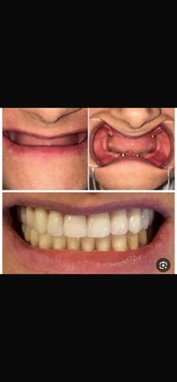 طالبة طب اسنان • طقم اسنان • الرمادي