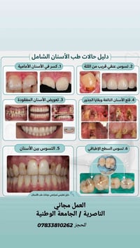 عيادات أسنان مجانية • الناصرية • تعويض أسنان