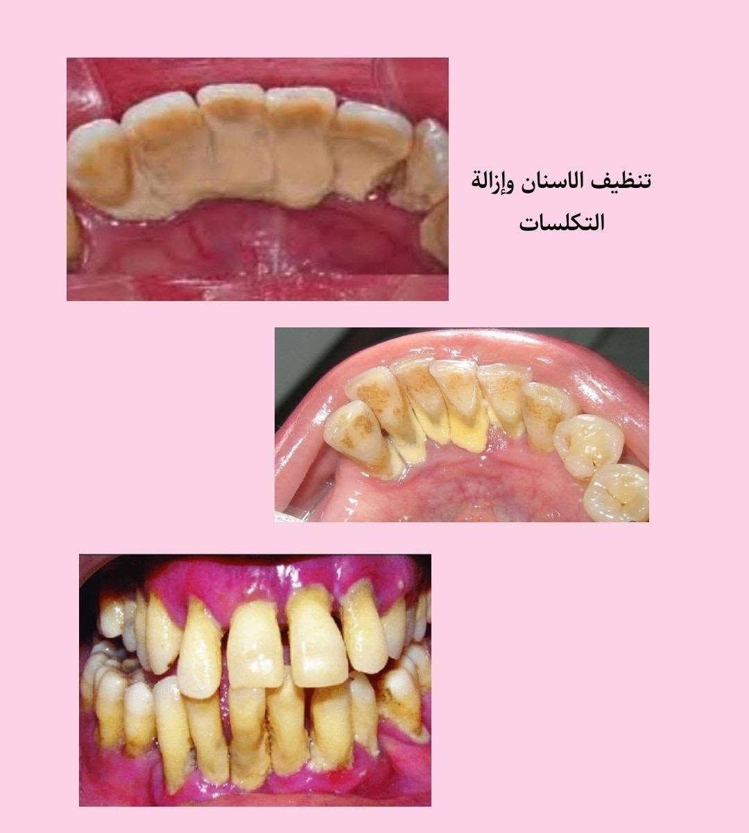 علاج مجاني • جامعة البيان • طب أسنان