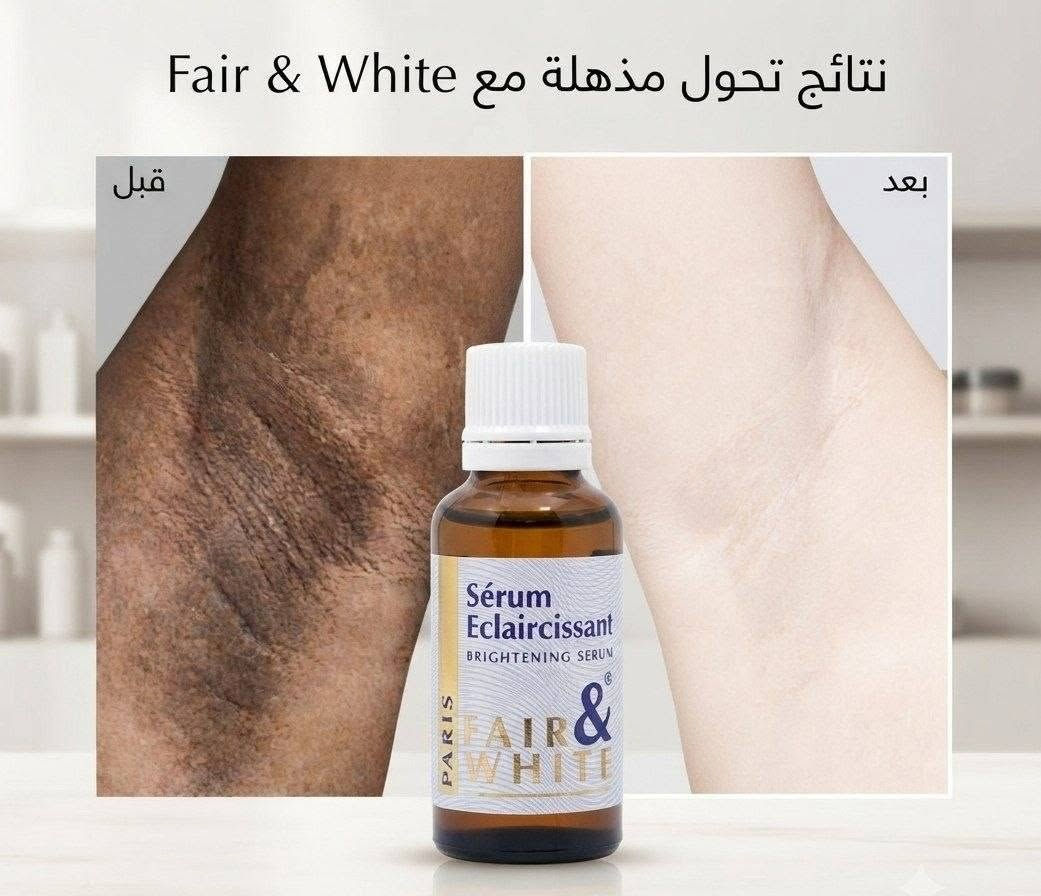 سيروم الفرنسي 
اذا جنتي تعانين من تصبغات قوي تحت الابط 
وبالمنطقة الحساسة 
جربتي هواية شغلات هل السيروم يقشر بلطف يزيل السواد ينضف الج المنطقة بشكل نهائي 
المنطقة بشكل 
بياض طبيعي 🌸🌸

للحجز ***********
