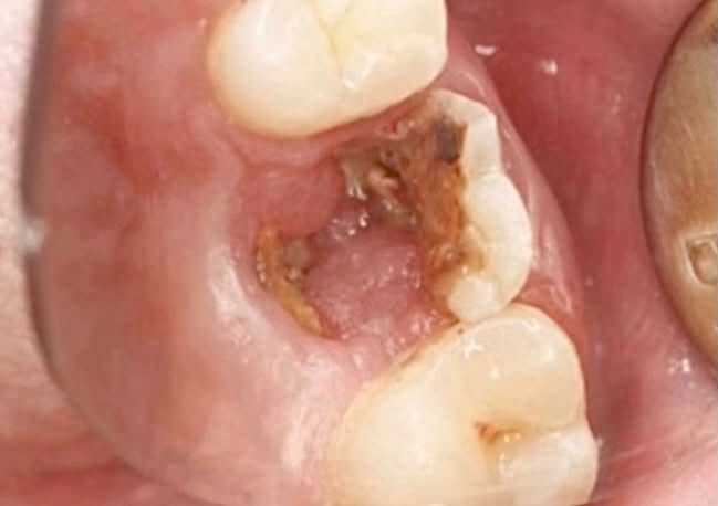 حشوات تجميلية • تنظيف أسنان • شبه مجانية