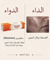 آثار_الحبوب • تصبغات • العناية_بالبشرة
