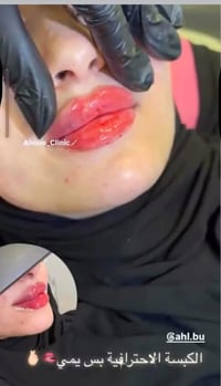 اوسلين كلينك • سبع بكار • تجميل أسنان