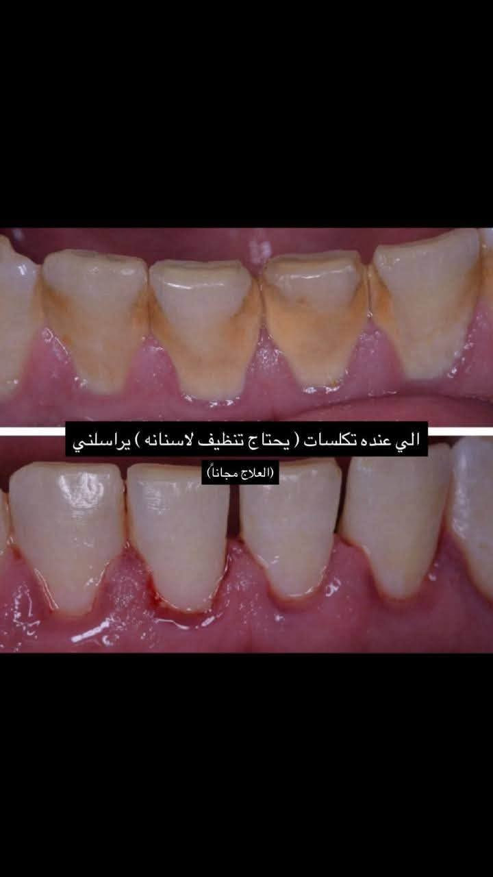 علاج مجاناً • عيادة أسنان • جامعة الزهراوي