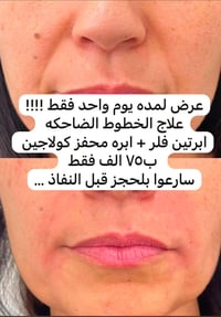 عرض ٩/٦ • محمودية • صالون تجميل