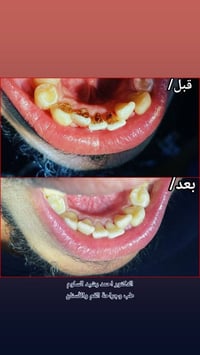 حجز موعد • دكتور احمد السلوم • اليوسفية
