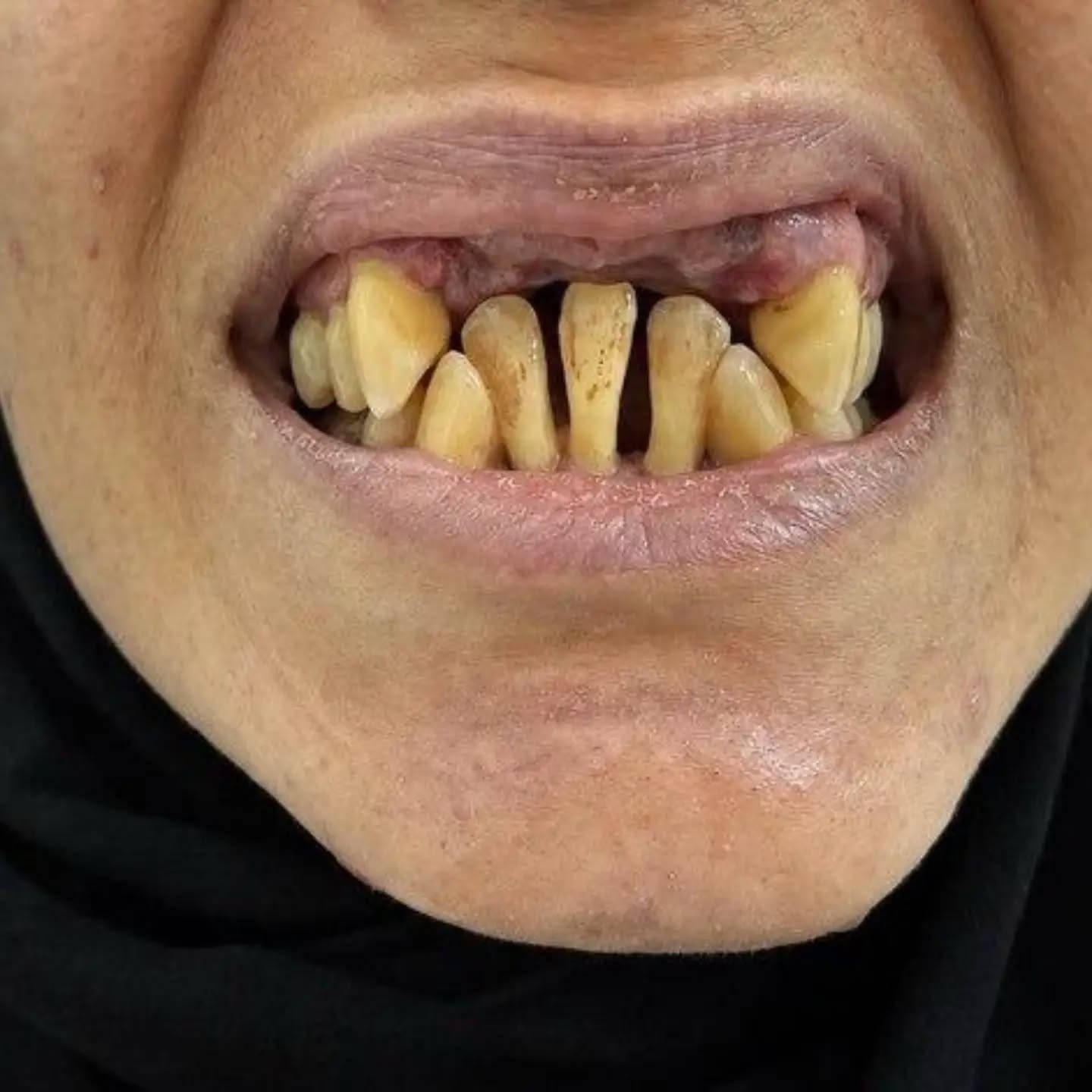 ✨ ابتسامتچ تستاهل تكون أجمل! ✨

تجميل الأسنان مو بس يغيّر شكل الأسنان، إنما يمنحچ ابتسامة مرتبة وثقة أكبر بنفسچ 🤍🦷

🌸 تصميم ابتسامة يناسب ملامحچ
✨ تحسين شكل ولون الأسنان
🦷 نتائج طبيعية وأنيقة
💎 اهتمام بأدق التفاصيل

📍 مركز سما المناذرة لطب الأسنان
خلي ابتسامتچ تحچي عن جمالچ 🤍

العنوان / النجف الاشرف _ المناذرة _ الشارع العام _ قرب مستشفى
 المناذرة _عمارة الحاج ابو نبيل جانب صيدلية الأصالة
 للحجز والأستفسار  / ***********
الساعه 8:00 صباحا الساعه 12:00 ظهرا من الساعه 3:00 ظهرا الى الساعه 9:00 ليلا ًَ
