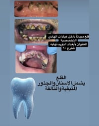 قلع مجاناً • جامعة الهادي • الثلاثاء