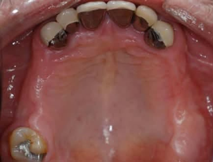 بعيادات جامعة كلكامش 🦷
⭕️ نشتغل طقم جزئي متحرك
❗️العلاج تحت إشراف اطباء اختصاص 
📍العنوان : الدورة / ابو دشير / جامعة كلكامش
التواجد : السبت - الاحد - الاثنين
🕙وقت العيادة: 10 
 
📞 واتساب :
 ***********
