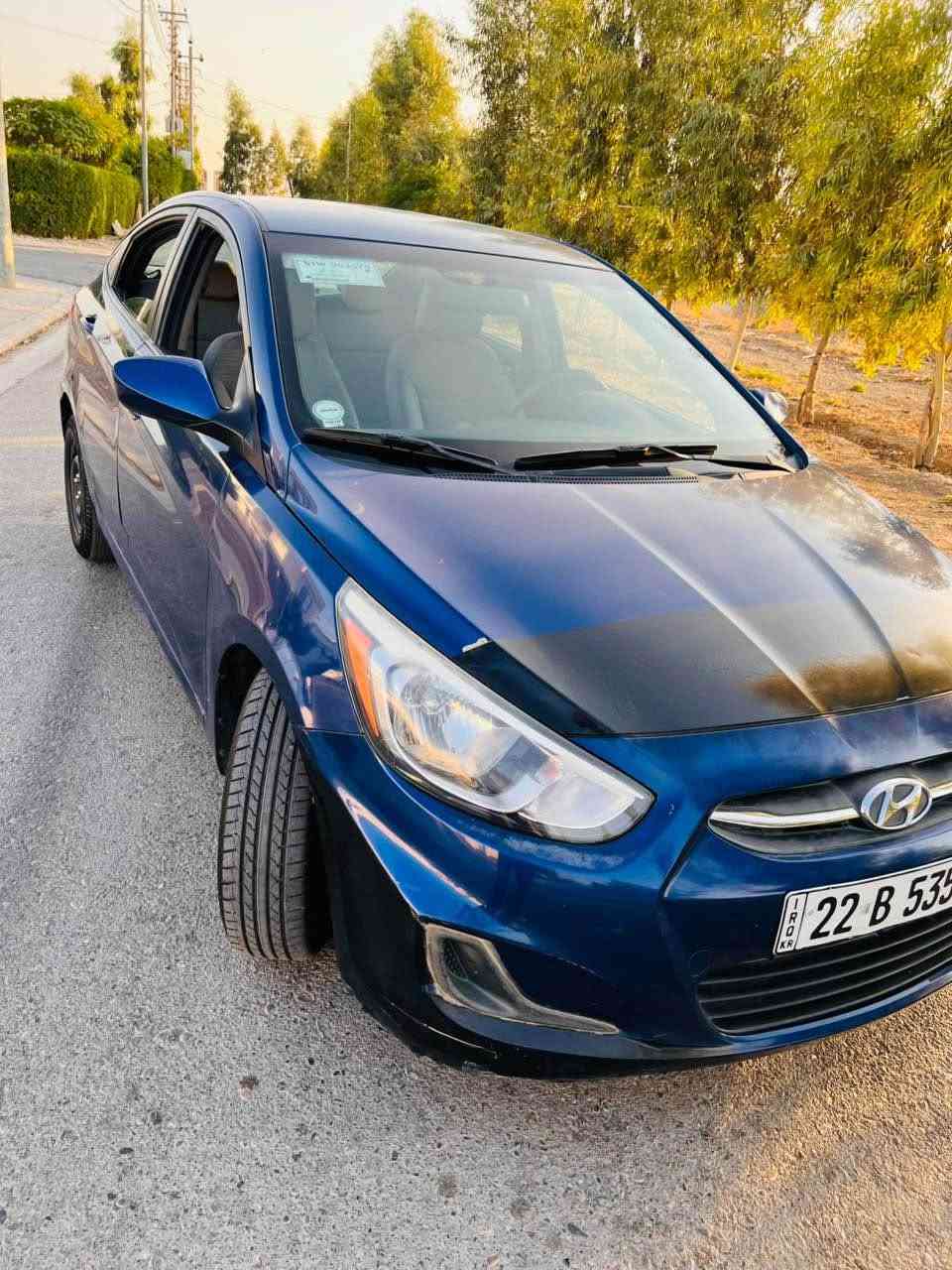 اکسنت ٢٠١٧
قبغ سندوك و جملغین خلفي صبغ
صورە سونار موجودە
رقم و سنوي جدید
سعر ٩٤ ورقە و بیها مجال
مکاني اربیل
رقم صاحب سیارە 
*********** واتساب موجودە أربيل, العراق
