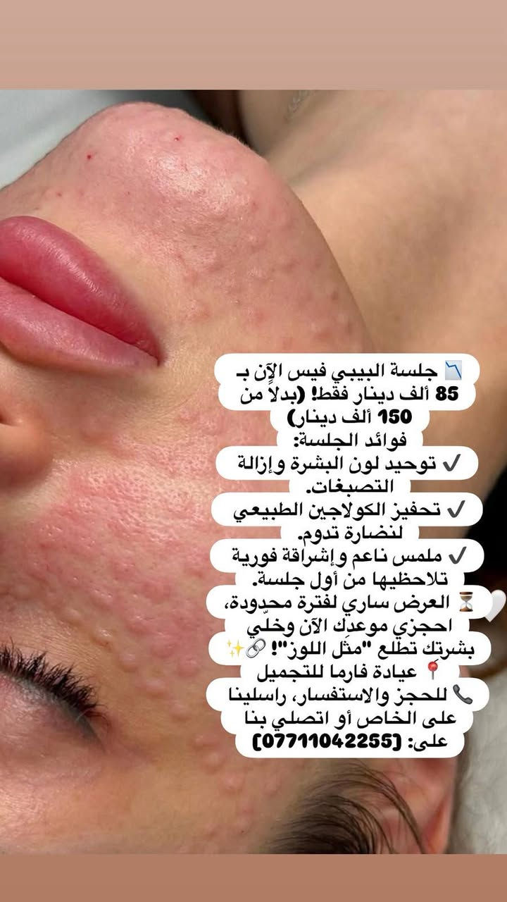 جلسة بيبي فيس • توحيد لون • عيادة فارما