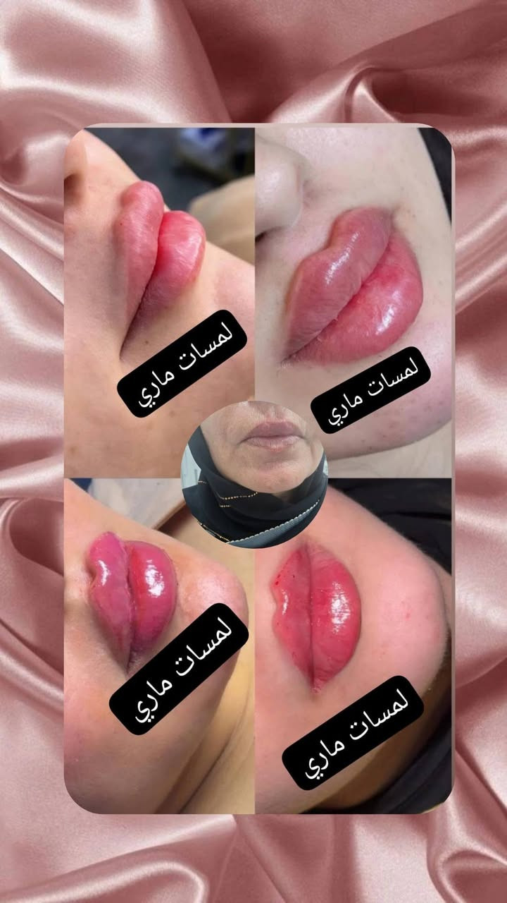 مكاني السيديه + الاعضميه للحجز على رقم الهاتف
***********
