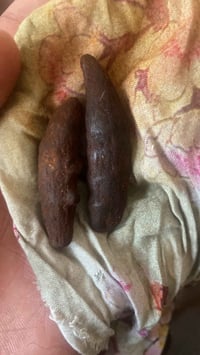 حجر هبهاب نازف • طبيعي • شرط الفحص