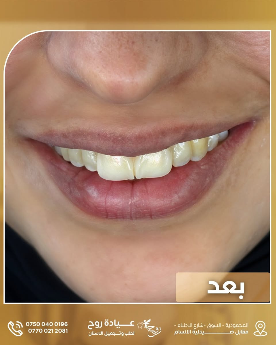 عيادة روح • تجميل أسنان • المحمودية