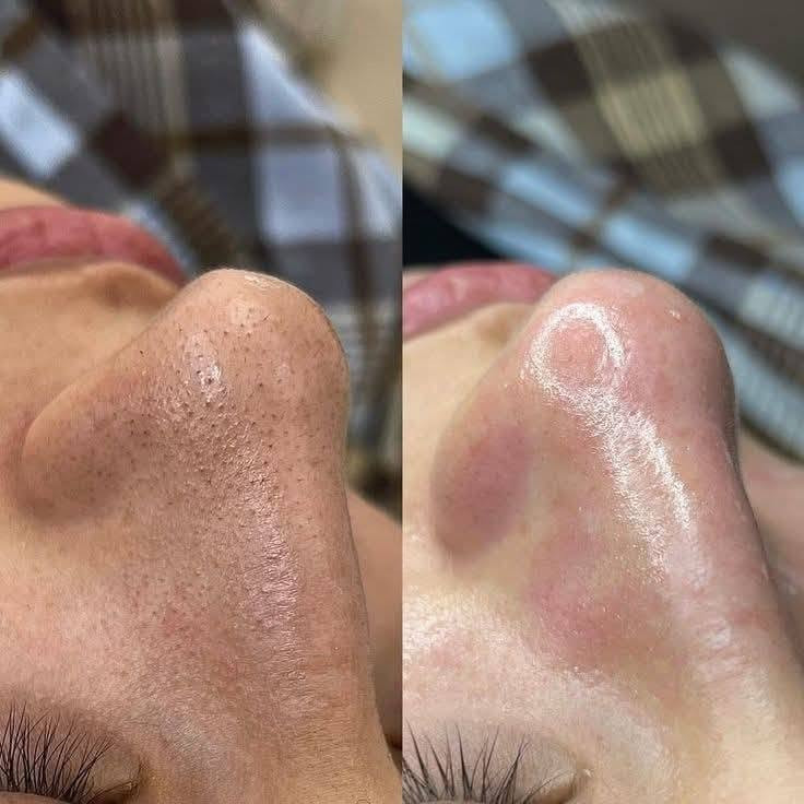 المسرة بيوتي • ميش شعر • تنظيف بشرة