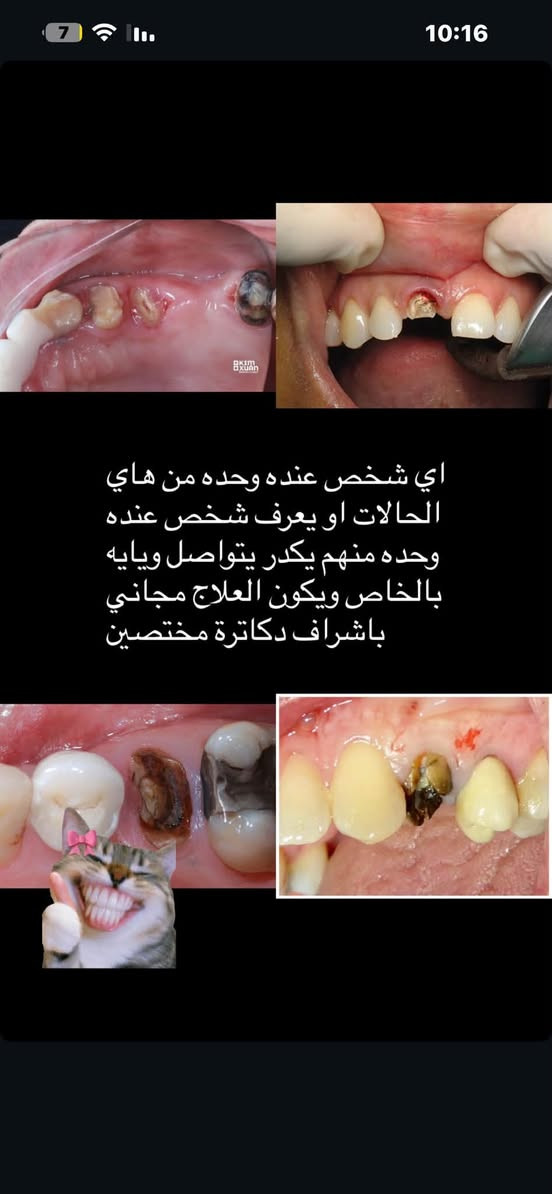 جميع الحالات المذكورة مجاني للتواصل على الواتس اب ***********
