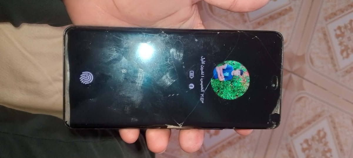 هونر X9c • ٢٥٦ • شاشة مبدلة