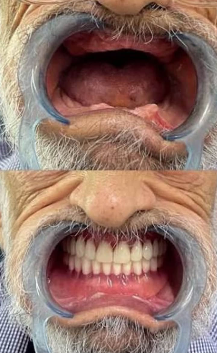 السلام عليكم اللي يحتاج طقم اسنان كامل او جزئي يراسلني على هذا الرقم *********** علمًا بأن العلاج مجاني 
المكان: كرادة/ ساحة الاندلس/ عيادات جامعة الاسراء
