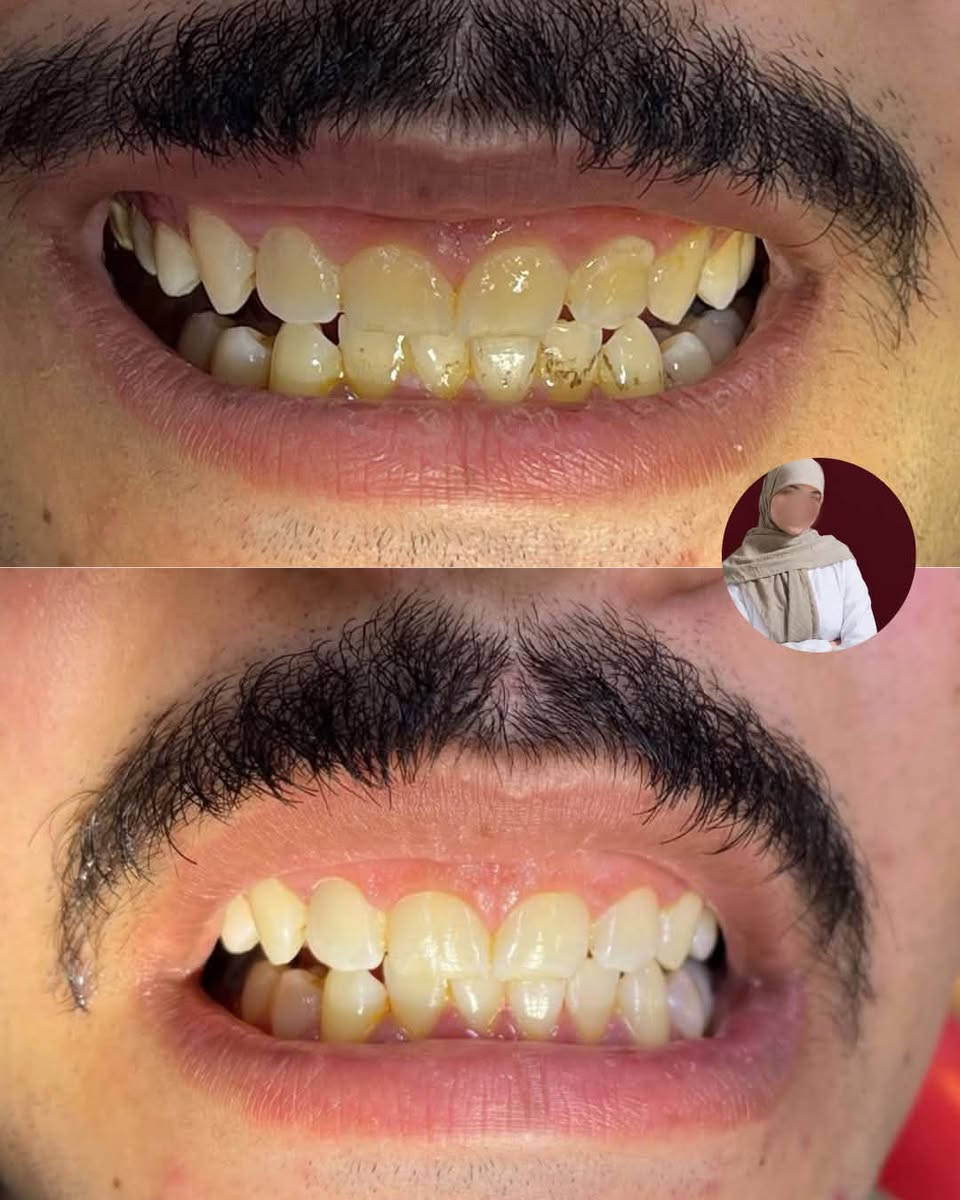 تنظيف الأسنان • قلع الأسنان • بغداد باب معظم