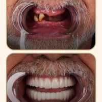 طب أسنان • الزبير • الرشيدية سنتر