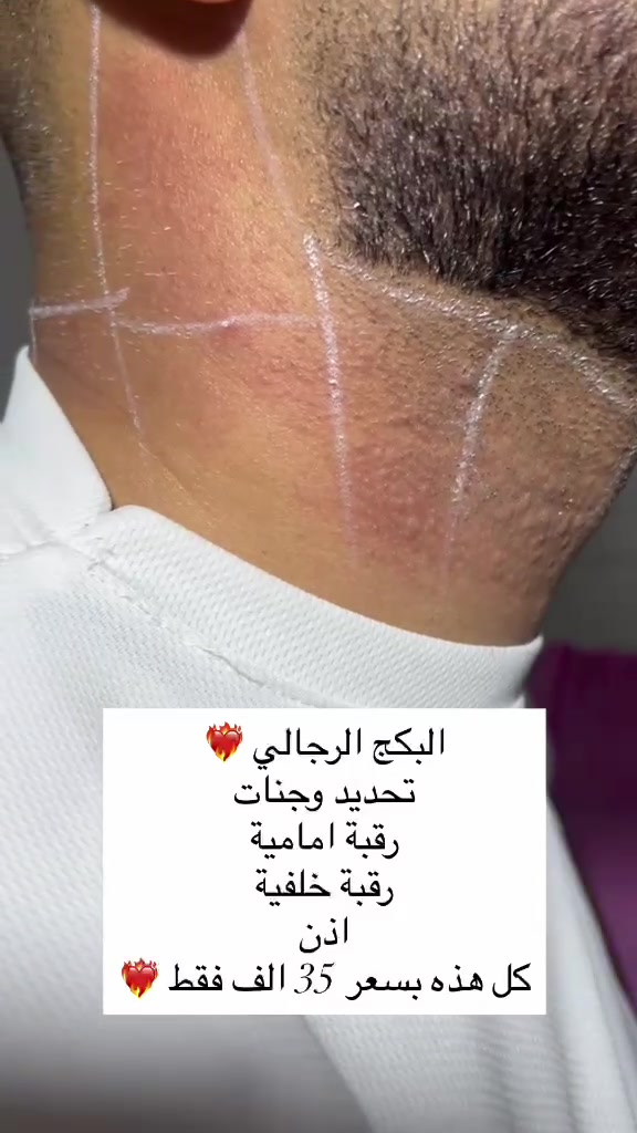 عروض الليزر
✨ مركز لكِ للتجميل والليزر
جلدية | ليزر | أسنان | تغذية | جم | صالون
📍 بغداد الجديدة  – مقابل أبو توني 
📞 ***********
📞***********
🤍 لأن جمالكِ يستحق الأفضل
