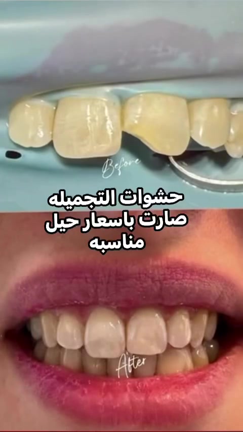 لا توجد تفاصيل
