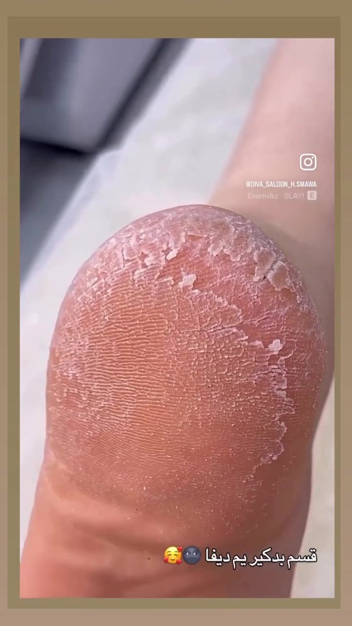 نبأ الشمري

عروض صالون ديفا 🥰🥰

نستقبلكم داخل صالون من ساعه ١٠ صبح للساعه ٩ ليلا بدون حجز😍

سماوه الغربي مقابل متنزه الورده 

***********

https://www.instagram.com/diva_saloon_h.smawa?igsh=dTEyYm1xc2lianJ0
