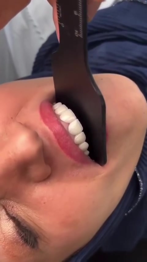 🦷✨ ابتسامة أجمل تبدأ من هنا ✨🦷

لأن جمال ابتسامتك ينعكس على ثقتك بنفسك، نقدم لكم أفضل خدمات طب الأسنان بأحدث التقنيات وأعلى معايير الجودة.

متواجدين لخدمتكم طيلة أيام الأسبوع #الشركة_الطبية_العالمية 

🔻
🏢 العنوان / بغداد _ الزعفرانية  الاربع شوارع _ مجاور مدرسة الاميرات ..
📲 للحجز والاستفسار 
***********
#مركز_سما_الزعفرانية_لطب_وتجميل_الاسنان
