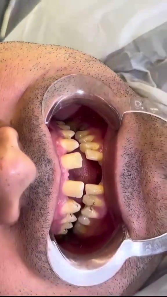 مركز ماسة الحسينية التخصصي لطب وجراحة الفم والأسنان 

📅 متواجدون طيلة أيام الأسبوع لخدمتكم.
📍 العنوان: بغداد - الحسينية - خلف السوق الأول - شارع 20
📱 للاستفسار والحجز: ***********
أهلاً وسهلاً بكم ❣️
#مركز_ماسة_الحسينية #تجميل_الأسنان #ابتسامة_هوليوود #فينير #بغداد_الحسينية #أسنان_بيضاء
