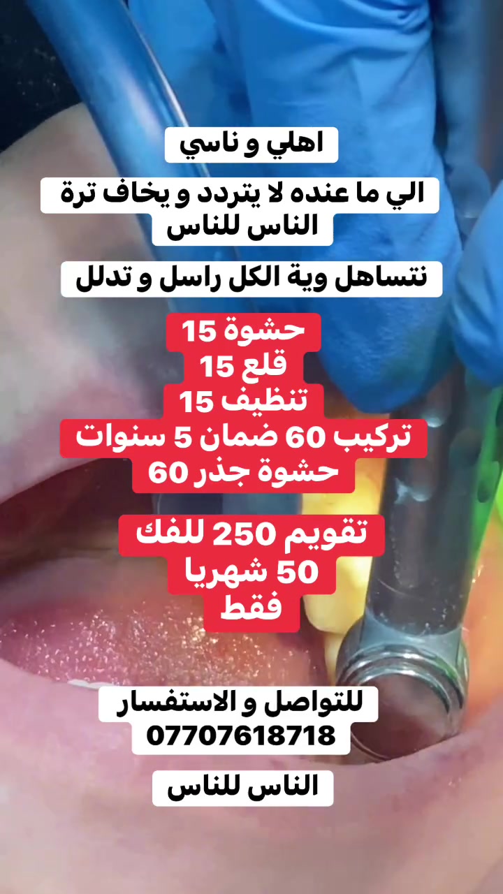 اخواني الي ما عنده يراسل و يدلل

***********
