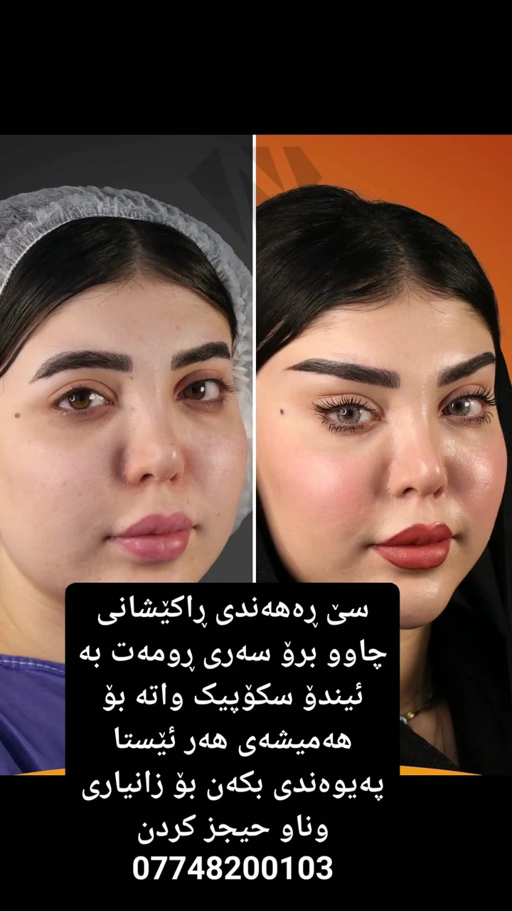 بۆ زانیاری دەربارەی کارەکانمان ئەتوانن پەیوەندی بکەن لە ڤایبەر یان لە واتس ئاپ یان،تلیگرام ***********
