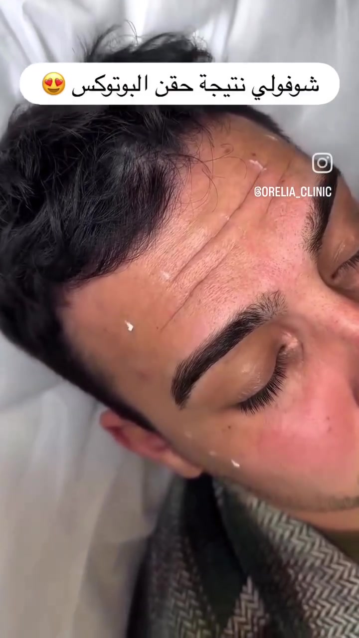 ​✨ ابتسامتك وجمالك… يكتملون في عيادة أوريليا! ✨
كل ما تحتاجه لابتسامة ساحرة وإطلالة مشرقة بمكان واحد، بإشراف أطباء اختصاص وبـ أنسب الأسعار ونتائج مضمونة 💎
​🦷 خدمات طب وتجميل الأسنان:
​ابتسامة هوليوود، تبييض ليزري، حشوات تجميلية، وزراعة وتقويم بأحدث الأجهزة وبدون ألم.
​💉 قسم التجميل اللاجراحي:
​حقن الفلر، البوتوكس، جلسات النضارة والبروفايلو لإطلالة طبيعية وشابة.
​📍 العنوان: بغداد - الغزالية - شارع البدالة - مجاور مكوى الغزالية
​📞 للحجز والاستفسار: *********** دكتورة كوثر 
​عيادة أوريليا.. لأنك تستحق الإطلالة الأفضل! ✨
