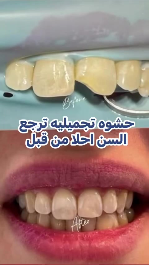 لا توجد تفاصيل
