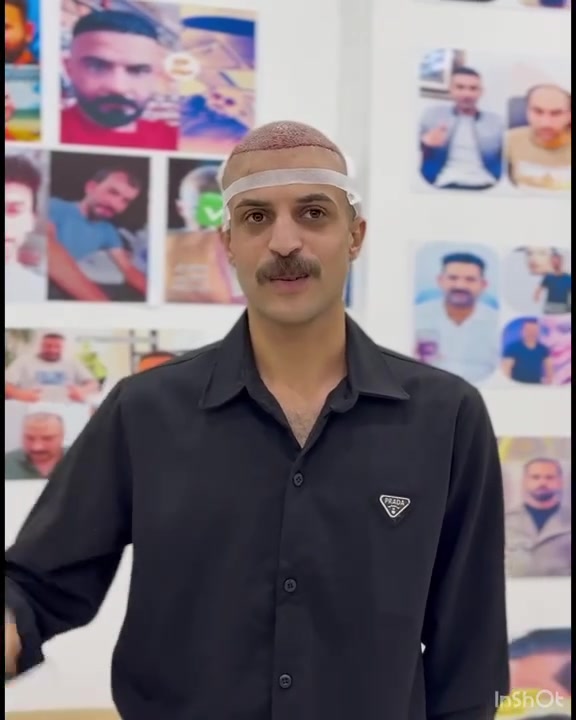 وهذه بالنسبة إلنا مو مجرد شهادة…
هذا دليل على ثقة أخونا تاج ورضاه عن طريقة العمل والتعامل
بنسانية قبل كل شي 

في مركز المتخصص، الـVIP مو مجرد كلمة 
هو تعامل  مصداقية  وزراعة بحتراف. وشغل  مدروس 
 ودقة بالتفاصيل، واهتمام حقيقي بالمريض.

اختلاف جذري يبدأ من طريقة العمل… ويظهر بالنتيجة. 🔥

أخونا تاج، شكرًا لثقتك واختيارك إلنا،
ونتمنى لك تمام الشفاء والرضا، وأن تكون تجربتك بداية لنتيجة تفتخر بيها. ❤️

مركز المتخصص لزراعة الشعر 
 #لزراعة #الشعر #زراعةالشعر #بالسيداسيون #بغداد #الشعب #البصرة #تجميل #كربلاء #شعر #المحافظات
