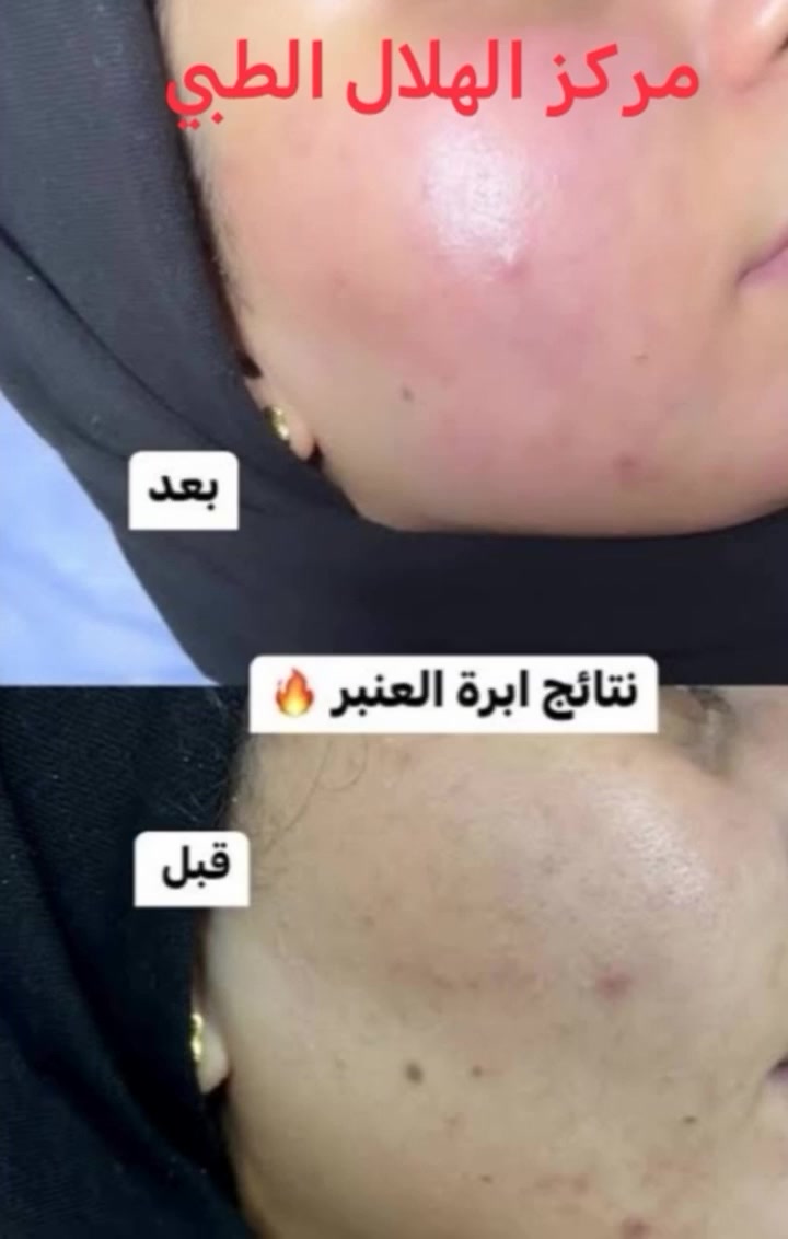 صالون تجميل • خدمات تجميل • لا تفاصيل